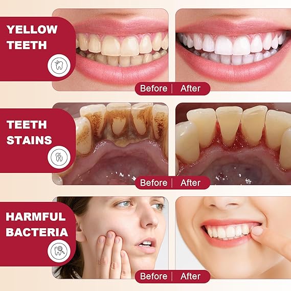 Sp-4 Toothpaste (120g)